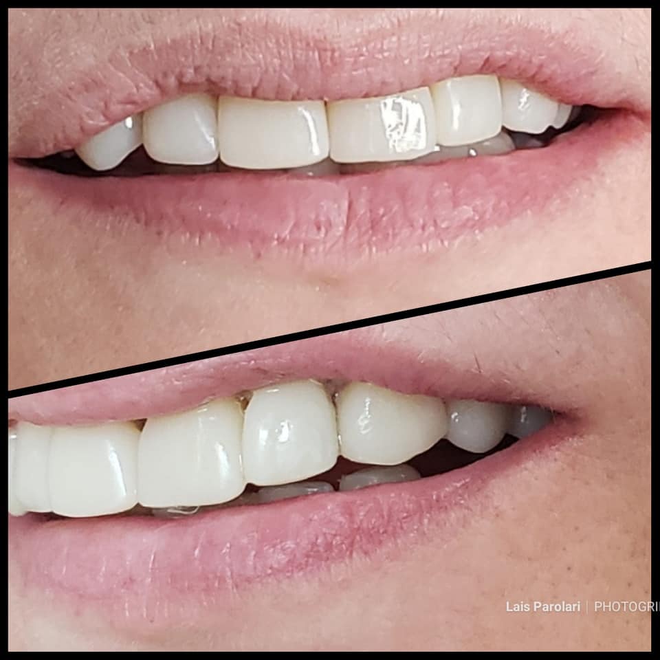 Energia Solar em Catanduva/SP (Chacara Nosso Recanto e Vila Bella Eventos) - Luz Sol Energia Solar